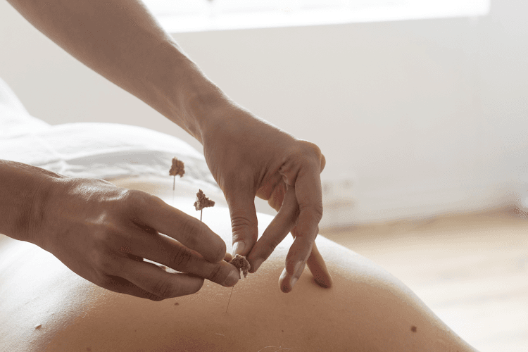 Adelina Acupuncture clinic