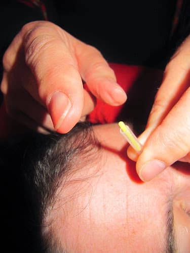 Denise Platt Lichtig M.S., Dipl., O.M., L.Ac. clinic