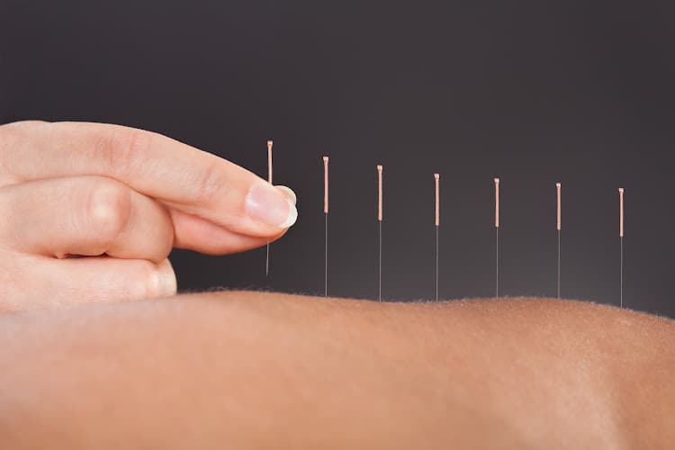HoodMed Acupuncture clinic