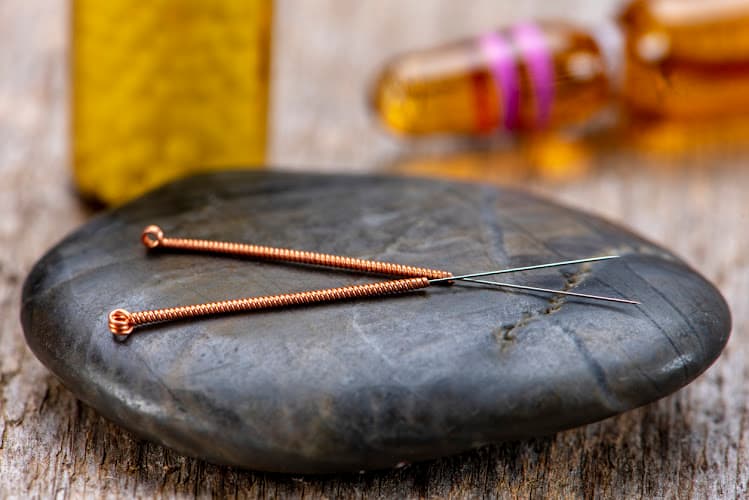 Harry Chauss, Acupuncturist clinic