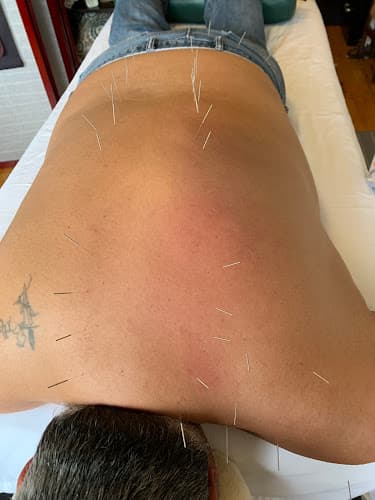 Acupuncture for Optimal Health clinic
