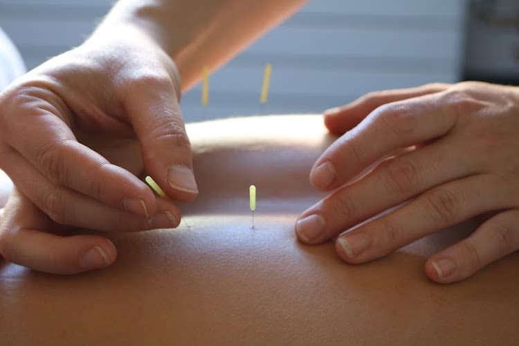 Wulf Acupuncture clinic