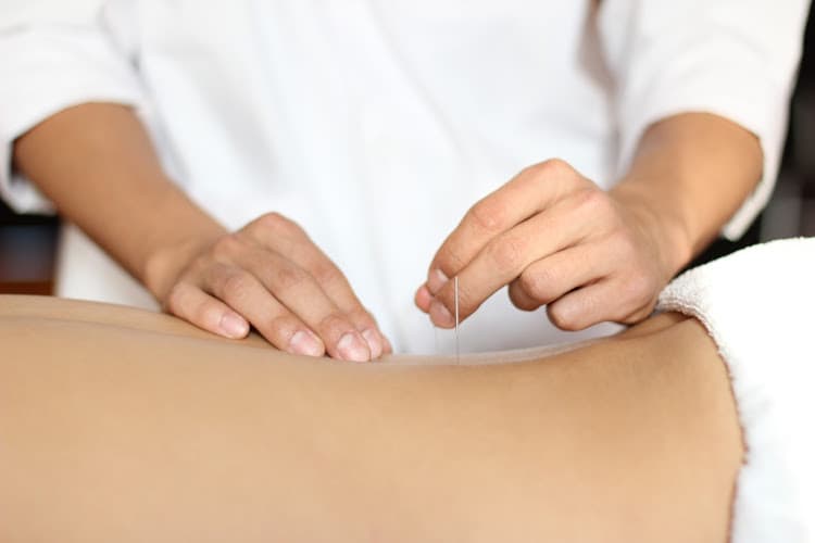 Hilltop Acupuncture clinic