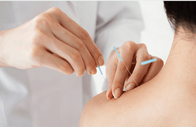 Acupuncture Infertility NYC Specialists clinic