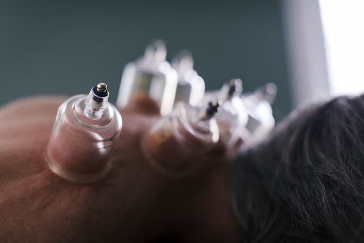 Classical Acupuncture Clinic clinic