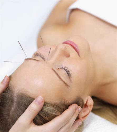 Arlington Acupuncture Clinic clinic