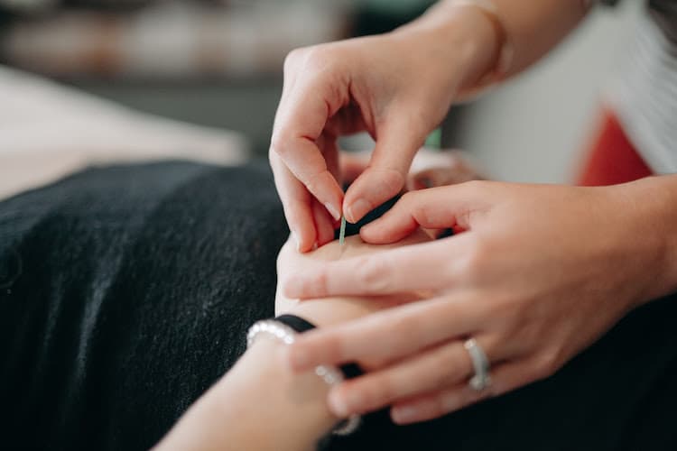 Acupuncture Healing Corner clinic