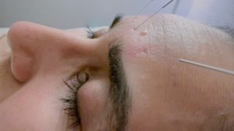 Dharma Reiki & Acupuncture clinic