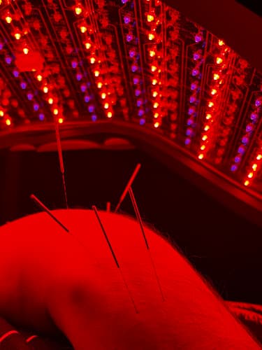 Roots and Needles clinic