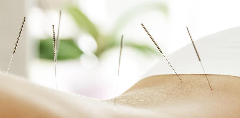 Jing Fang Li, MD, OMD, LAc Acupuncture clinic