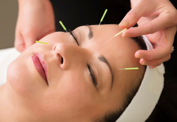 Transform Acupuncture & Wellness La Jolla clinic