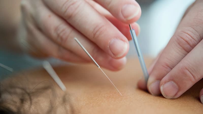 Kevin Kim Acupuncture (in Advanced Wellness Center) clinic