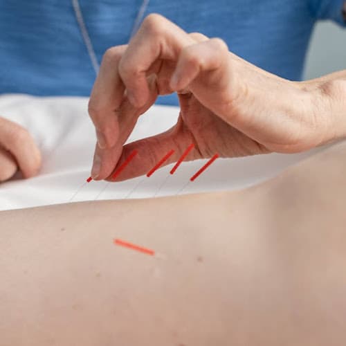 Radiant Light Acupuncture clinic