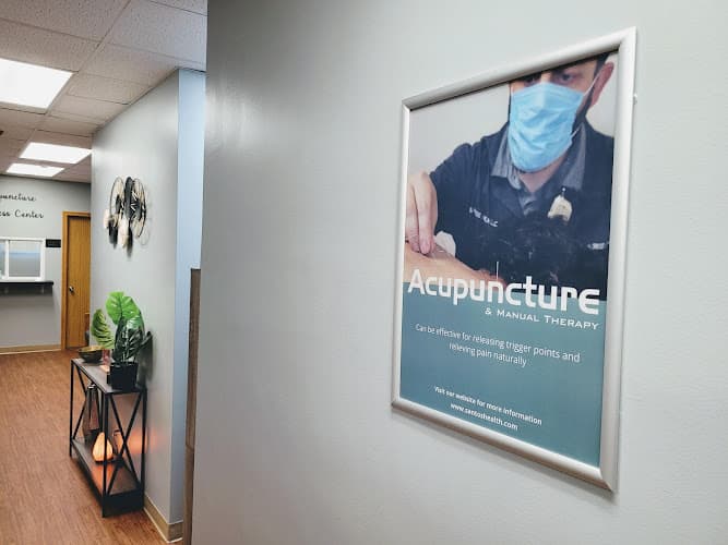 Hijama in Chicago | Acupuncture Pain & Wellness clinic