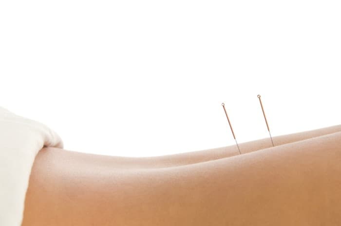Acupuncture & Integrative Wellness Center clinic