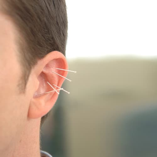 Brett VanCott Acupuncture: Dragonfly Oriental Medicine clinic