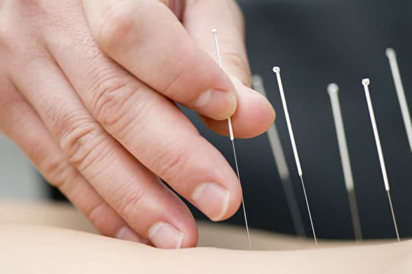 Acupuncture with over 45 years experience - Dr. Shan Kong clinic