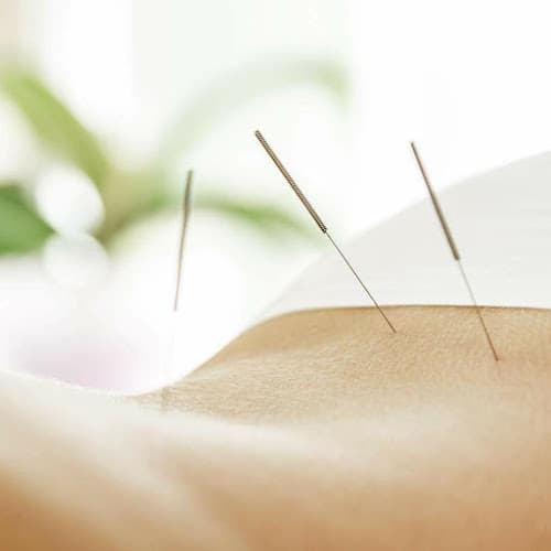 LouLou Piscatore, L.Ac. - Integrative Acupuncture clinic