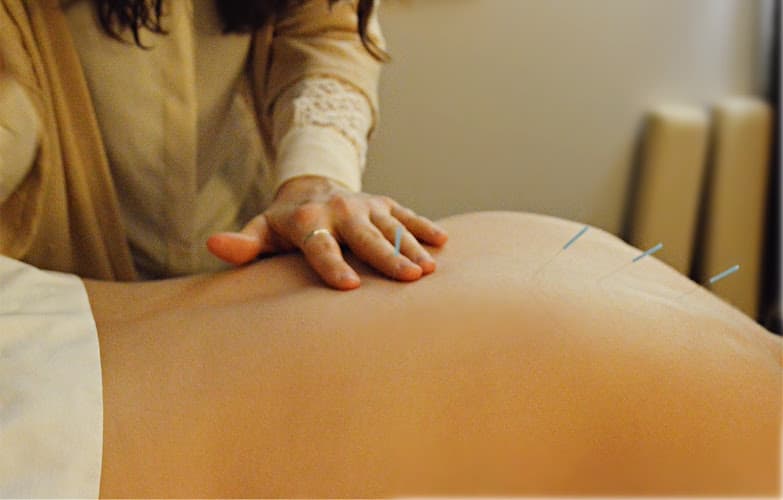 Natural Solutions Acupuncture Services clinic