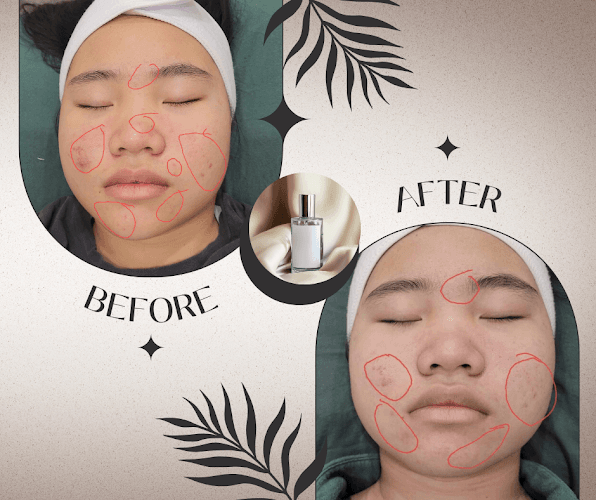 Catawba Natural Healing - Holistic Pain Specialist & Microneedling clinic