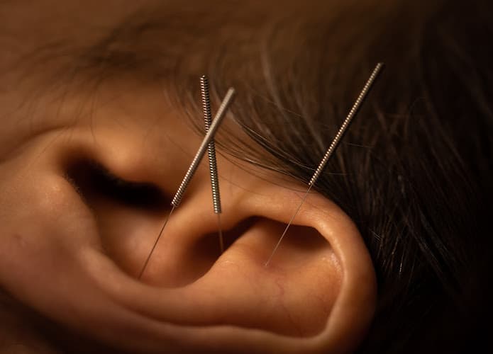 WellPoint Acupuncture and Chinese Herbal Medicine clinic