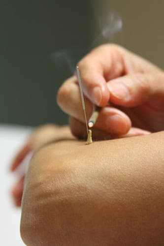 Bocangel Integrative Medicine & Acupuncture clinic