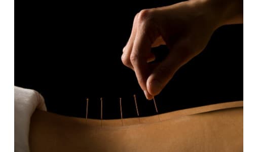 Points East Acupuncture and Healing Arts clinic